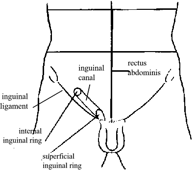 hernia picture